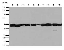 Western blot - Anti-NLP1 antibody [EPR16545] - BSA and Azide free (AB251143)