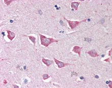 Immunohistochemistry (Formalin/PFA-fixed paraffin-embedded sections) - Anti-NLRC4 antibody (AB115537)