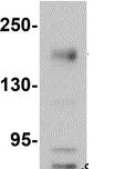 Western blot - Anti-NLRC5 antibody (AB105411)