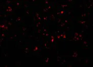 Immunocytochemistry/ Immunofluorescence - Anti-NLRP1 antibody (AB36852)