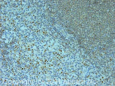 Immunohistochemistry (Formalin/PFA-fixed paraffin-embedded sections) - Anti-NLRP1 antibody (AB36852)