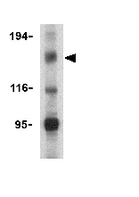 Western blot - Anti-NLRP1 antibody (AB36852)