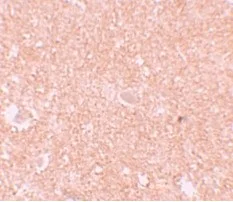 Immunohistochemistry (Formalin/PFA-fixed paraffin-embedded sections) - Anti-NLRP10 antibody (AB105407)