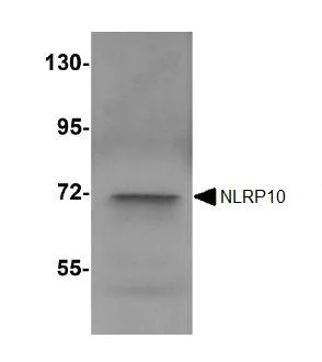 Western blot - Anti-NLRP10 antibody (AB105407)