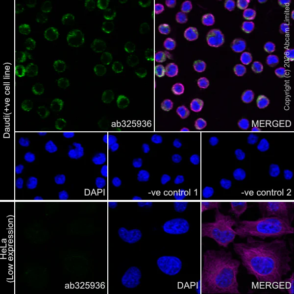 Immunocytochemistry/ Immunofluorescence - Anti-NLRP11 antibody [EPR29929-563] (AB325936)