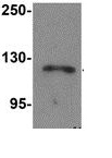Western blot - Anti-NLRP13 antibody (AB105410), expandable thumbnail