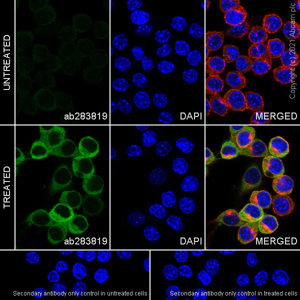 Immunocytochemistry/ Immunofluorescence - Anti-NLRP3 antibody [RM1021] (AB283819)