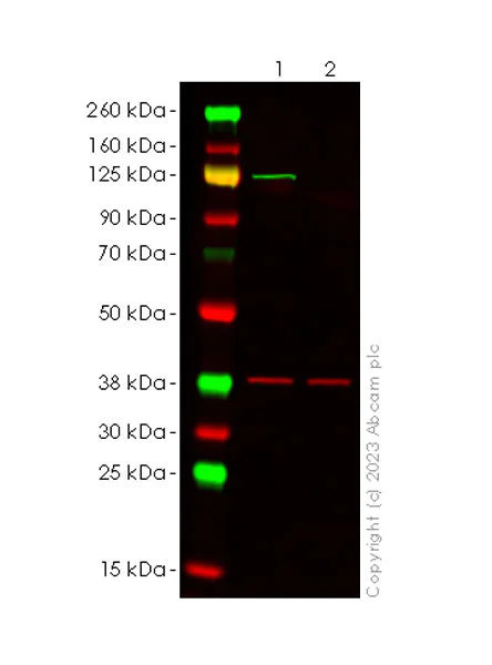 Western blot - Anti-NLRP3 antibody [RM1021] (AB283819)