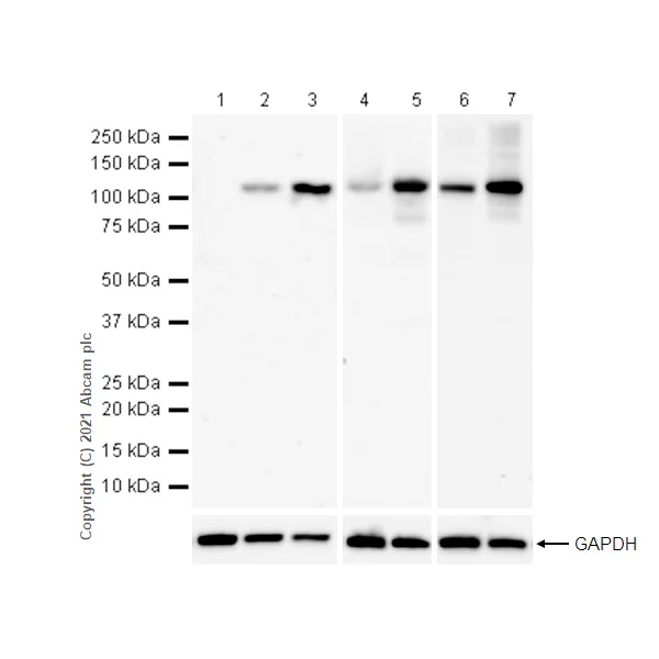 Western blot - Anti-NLRP3 antibody [RM1021] (AB283819)