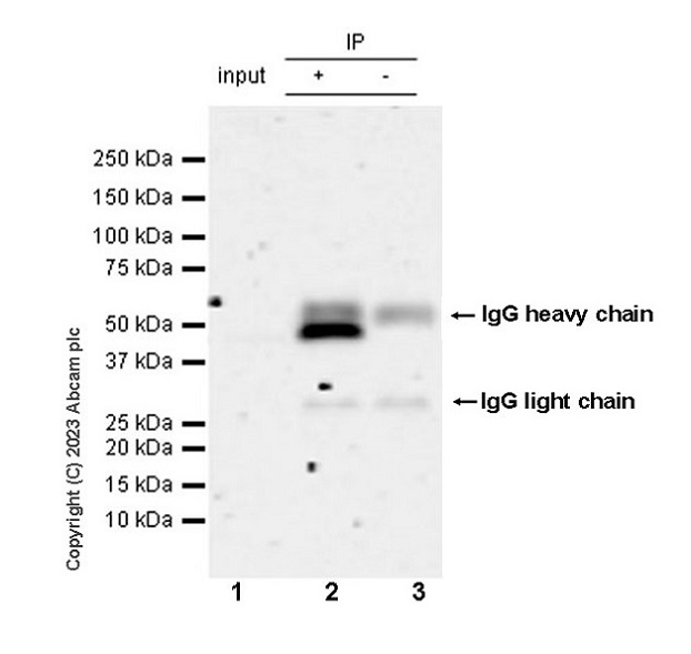 Immunoprecipitation - Anti-NLRP3 antibody [RM1021] - BSA and Azide free (ab314905), expandable thumbnail