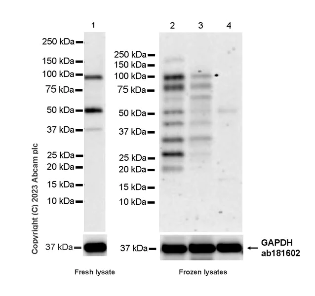 Western blot - Anti-NLRP6 antibody [EPR28233-48] - BSA and Azide free (AB314499)