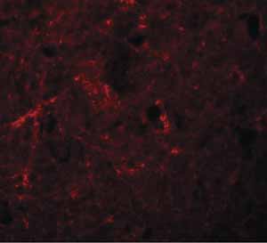 Immunocytochemistry/ Immunofluorescence - Anti-NLRP7 antibody (AB105405)