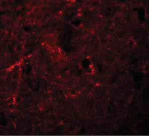 Immunocytochemistry/ Immunofluorescence - Anti-NLRP7 antibody (AB105405)