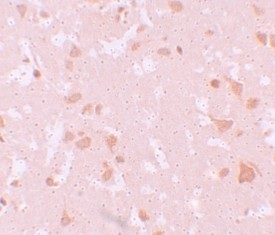 Immunohistochemistry (Formalin/PFA-fixed paraffin-embedded sections) - Anti-NLRP7 antibody (AB105405)