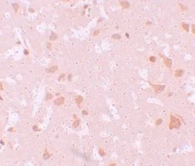 Immunohistochemistry (Formalin/PFA-fixed paraffin-embedded sections) - Anti-NLRP7 antibody (AB105405)