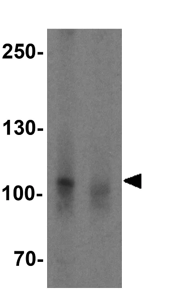Western blot - Anti-NLRP7 antibody (AB105405)