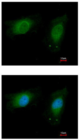 Immunocytochemistry/ Immunofluorescence - Anti-NM23A antibody (AB154547)