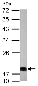 Western blot - Anti-NM23A antibody (AB154547)