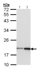 Western blot - Anti-NM23A antibody (AB154547)