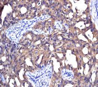 Immunohistochemistry (Formalin/PFA-fixed paraffin-embedded sections) - Anti-NM23A antibody [EPR3036] (AB92327)