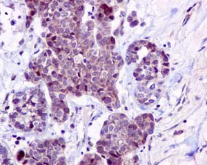 Immunohistochemistry (Formalin/PFA-fixed paraffin-embedded sections) - Anti-NMD3 antibody [EPR11979(B)] - BSA and Azide free (AB249576)