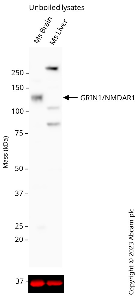 Western blot - Anti-NMDAR1 antibody [EPR2480Y] - Neuronal Marker (AB68144)