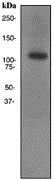 Western blot - Anti-NMDAR1 antibody [EPR2481(2)] (AB109182), expandable thumbnail