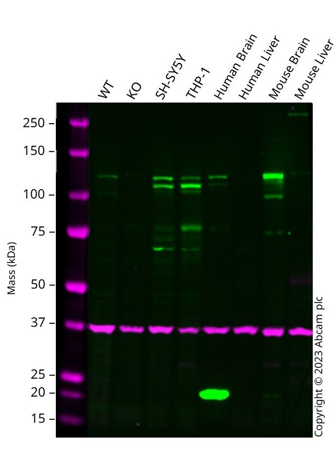 Western blot - Anti-NMDAR1 antibody [EPR2481(2)] - BSA and Azide free (AB239949), expandable thumbnail