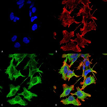 Immunocytochemistry/ Immunofluorescence - Anti-NMDAR1 antibody [N308/48] - Neuronal Marker (AB134308)