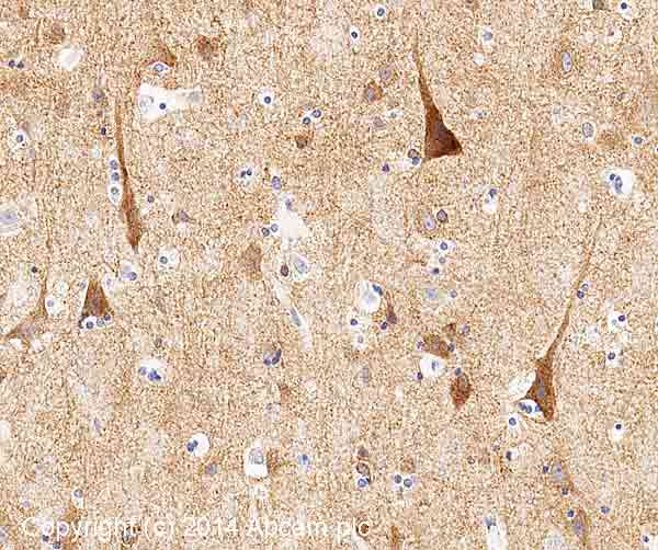 Immunohistochemistry (Formalin/PFA-fixed paraffin-embedded sections) - Anti-NMDAR1 antibody [N308/48] (AB193310), expandable thumbnail