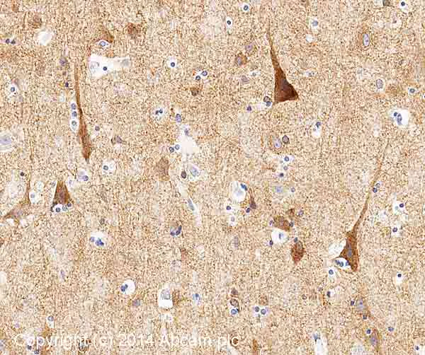 Immunohistochemistry (Formalin/PFA-fixed paraffin-embedded sections) - Anti-NMDAR1 antibody [N308/48] - Neuronal Marker (AB193310)
