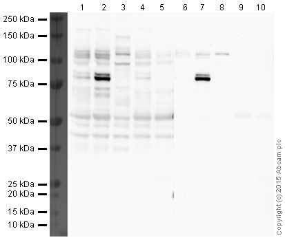 Western blot - Anti-NMDAR1 antibody [N308/48] - Neuronal Marker (AB193310), expandable thumbnail
