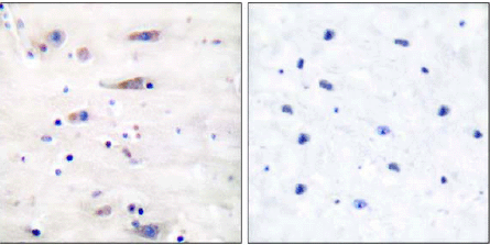 Immunohistochemistry (Formalin/PFA-fixed paraffin-embedded sections) - Anti-NMDAR1 antibody (AB52177), expandable thumbnail
