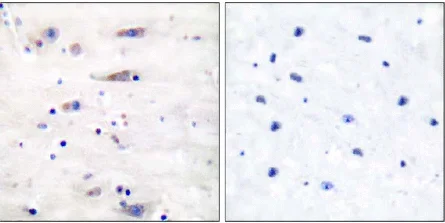 Immunohistochemistry (Formalin/PFA-fixed paraffin-embedded sections) - Anti-NMDAR1 antibody - Neuronal Marker (AB52177)