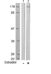 Western blot - Anti-NMDAR1 (phospho S896) antibody (AB75680)