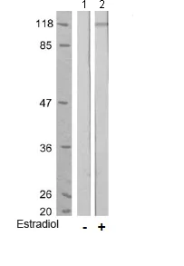 Western blot - Anti-NMDAR1 (phospho S896) antibody (AB75680)