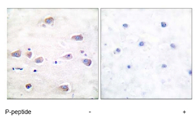 Immunohistochemistry (Formalin/PFA-fixed paraffin-embedded sections) - Anti-NMDAR1 (phospho S897) antibody (AB52184)