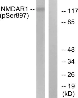 Western blot - Anti-NMDAR1 (phospho S897) antibody (AB52184)