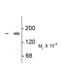 Western blot - Anti-NMDAR2A antibody (AB169873), expandable thumbnail