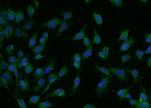 Immunocytochemistry/ Immunofluorescence - Anti-NMDAR2A antibody (AB203197), expandable thumbnail