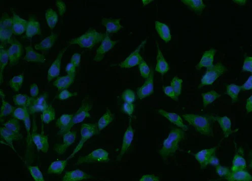 Immunocytochemistry/ Immunofluorescence - Anti-NMDAR2A antibody (AB203197)