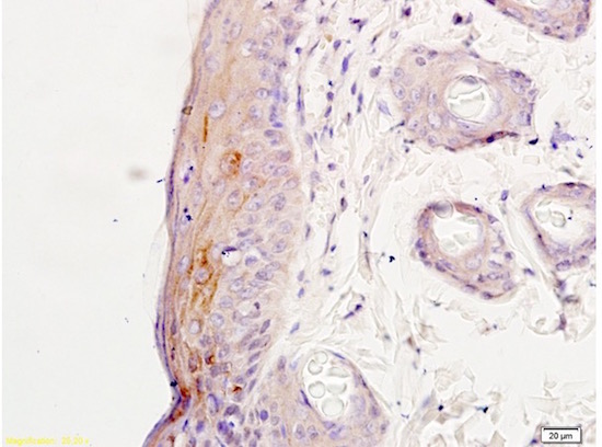 Immunohistochemistry (Formalin/PFA-fixed paraffin-embedded sections) - Anti-NMDAR2A antibody (AB203197), expandable thumbnail