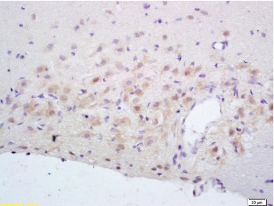 Immunohistochemistry (Formalin/PFA-fixed paraffin-embedded sections) - Anti-NMDAR2A antibody (AB203197), expandable thumbnail