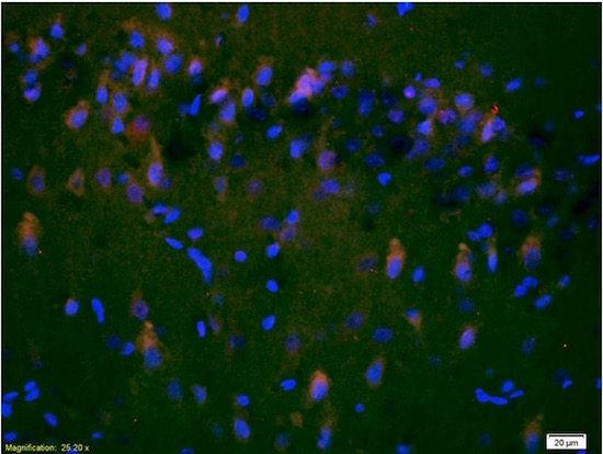 Immunohistochemistry (Formalin/PFA-fixed paraffin-embedded sections) - Anti-NMDAR2A antibody (AB203197), expandable thumbnail