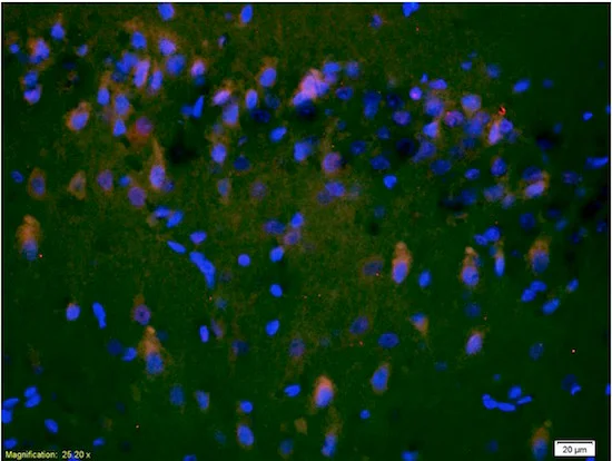 Immunohistochemistry (Formalin/PFA-fixed paraffin-embedded sections) - Anti-NMDAR2A antibody (AB203197)