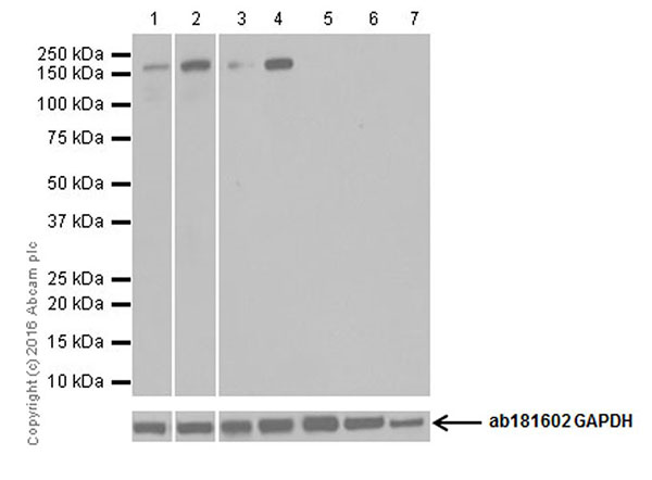Western blot - Anti-NMDAR2A antibody [EPR19694] (AB183939)