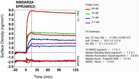 OI-RD Scanning - Anti-NMDAR2A antibody [EPR2465(2)] (AB124913), expandable thumbnail
