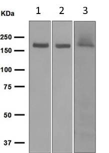 Western blot - Anti-NMDAR2A antibody [EPR2465(2)] (AB124913), expandable thumbnail