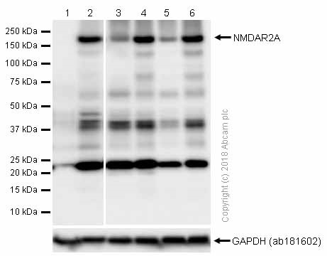 Western blot - Anti-NMDAR2A antibody [EPR2465(2)] (AB124913), expandable thumbnail