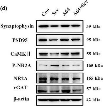 Western blot - Anti-NMDAR2A antibody [EPR2465(2)] (ab124913), expandable thumbnail